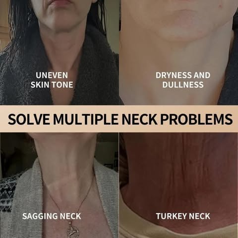 YCZ Rapid Lift Neck Firming Cream