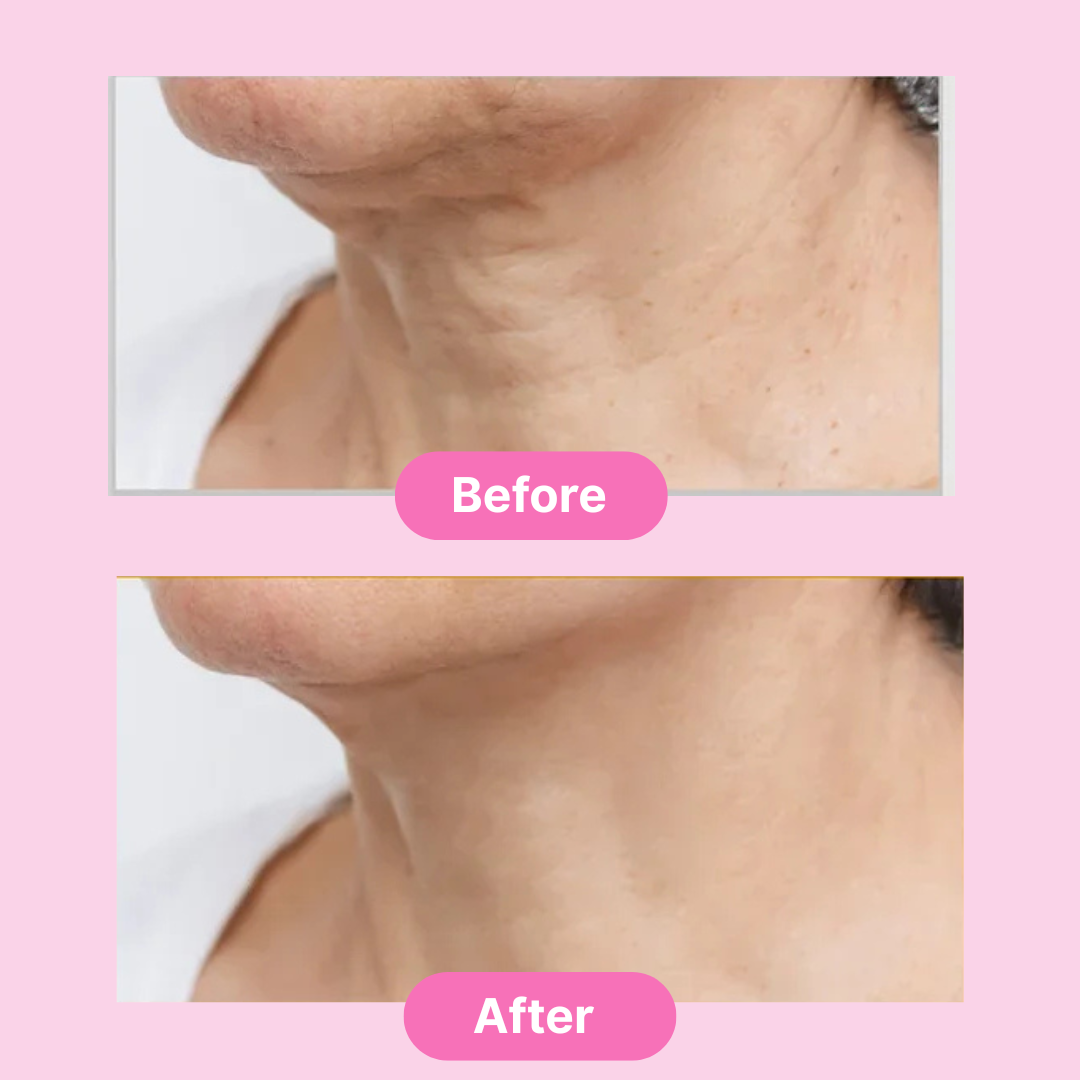 Glazed Skin Collagen Duo | Firming Cream + Volufiline Serum